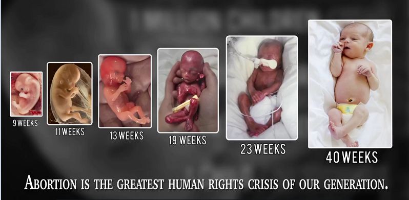 photo of 24 week fetus